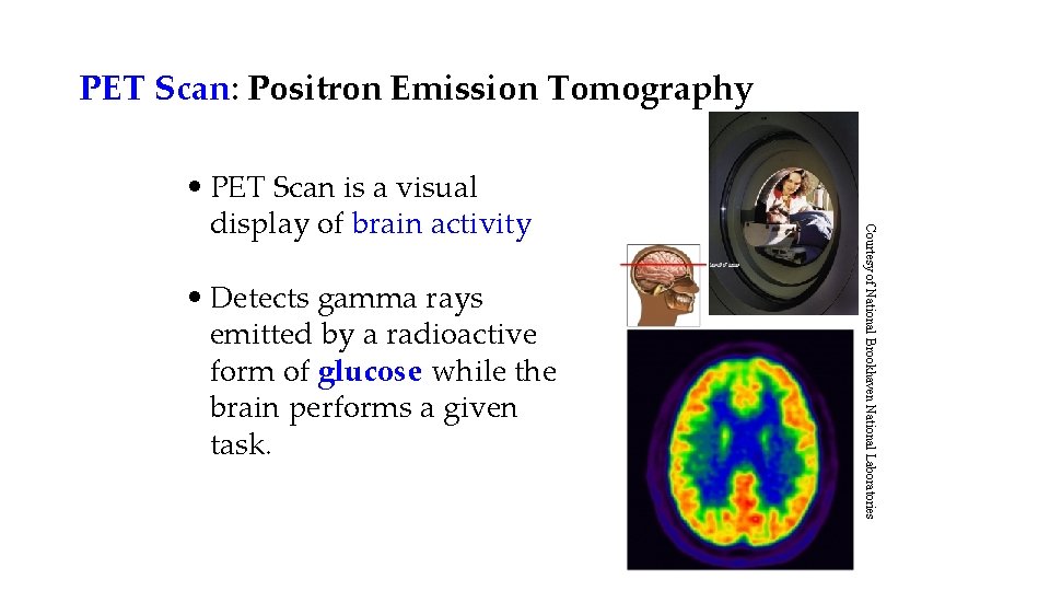 PET Scan: Positron Emission Tomography • Detects gamma rays emitted by a radioactive form