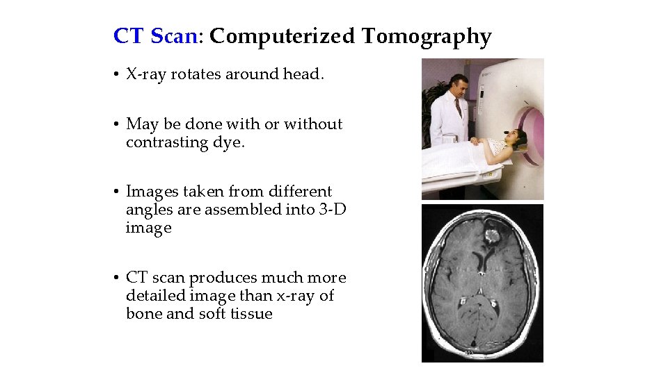 CT Scan: Computerized Tomography • X-ray rotates around head. • May be done with