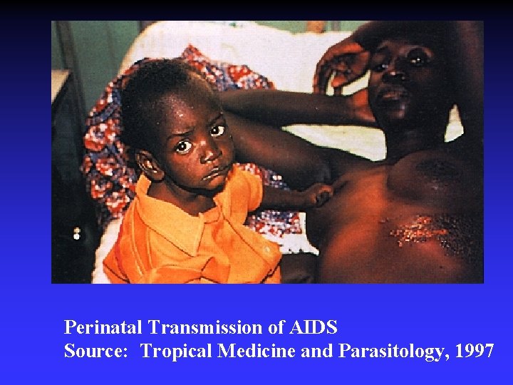 Perinatal Transmission of AIDS Source: Tropical Medicine and Parasitology, 1997 Perinatal Transmission of AIDS Source: Tropical Medicine and Parasitology, 1997