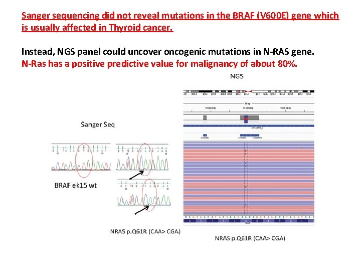 Sanger sequencing did not reveal mutations in the BRAF (V 600 E) gene which Sanger sequencing did not reveal mutations in the BRAF (V 600 E) gene which