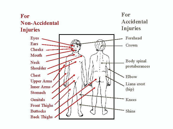 For Non-Accidental Injuries For Accidental Injuries Eyes Ears Cheeks Mouth Forehead Neck Shoulder Body