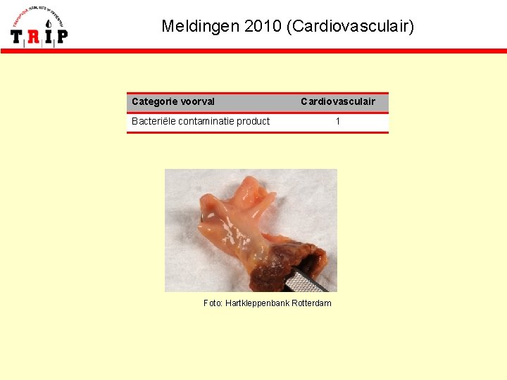 Meldingen 2010 (Cardiovasculair) Categorie voorval Cardiovasculair Bacteriële contaminatie product Foto: Hartkleppenbank Rotterdam 1 