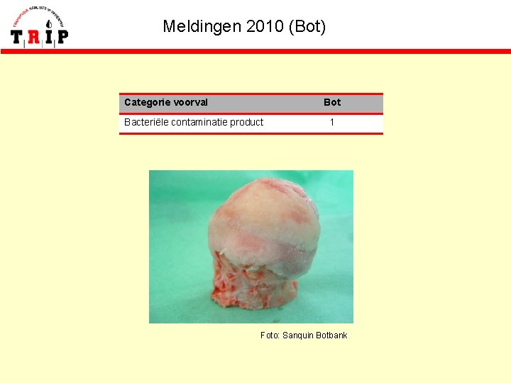 Meldingen 2010 (Bot) Categorie voorval Bot Bacteriële contaminatie product 1 Foto: Sanquin Botbank 