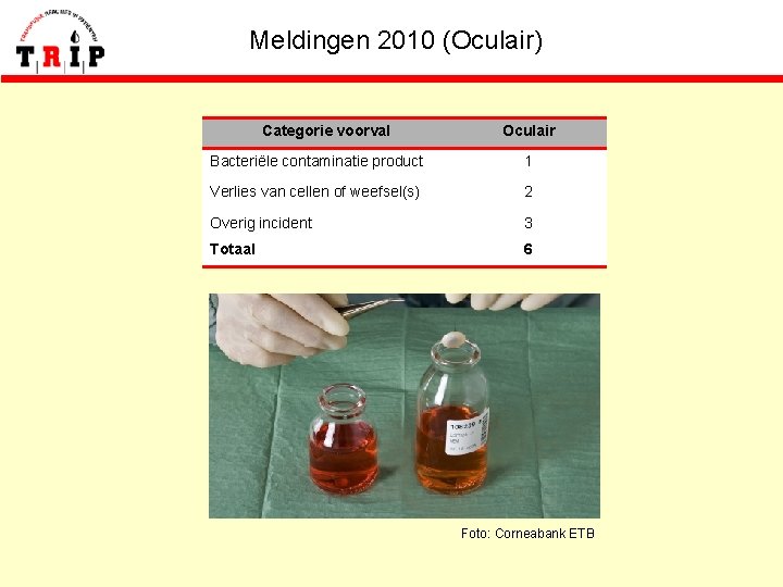 Meldingen 2010 (Oculair) Categorie voorval Oculair Bacteriële contaminatie product 1 Verlies van cellen of