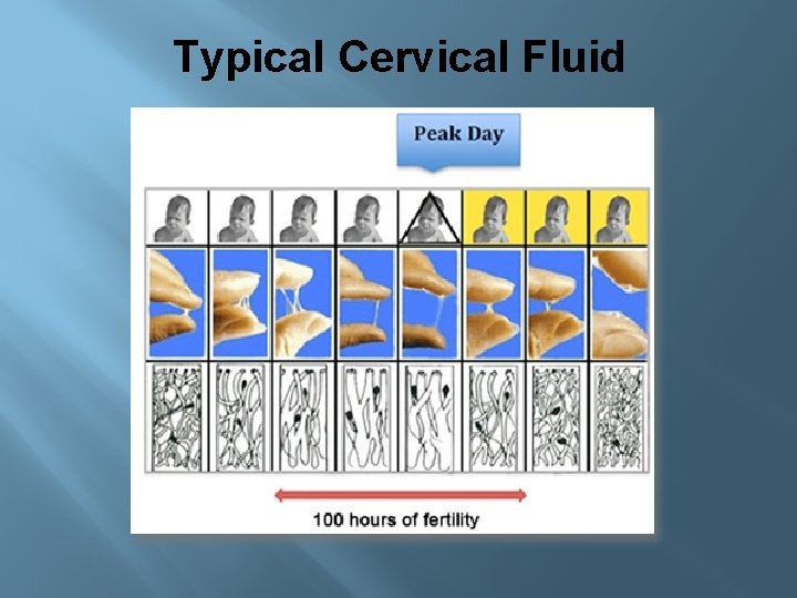 Typical Cervical Fluid 