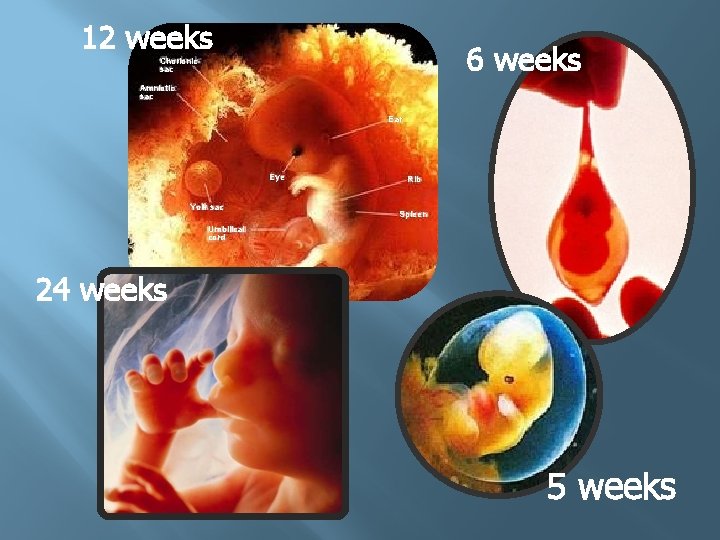 12 weeks 6 weeks Chorionic sac Amniotic sac Ear Eye Yolk sac Rib Spleen