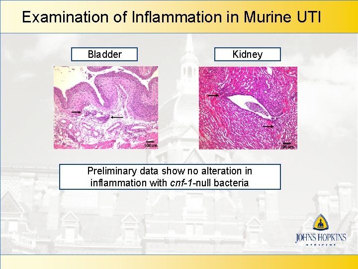 Examination of Inflammation in Murine UTI Bladder Kidney Preliminary data show no alteration in