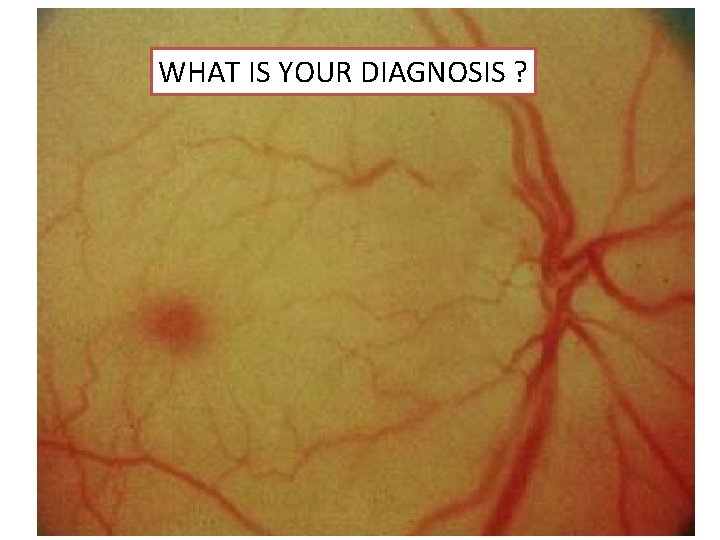 WHAT IS YOUR DIAGNOSIS ? 