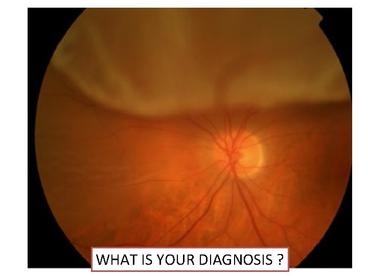 WHAT IS YOUR DIAGNOSIS ? 