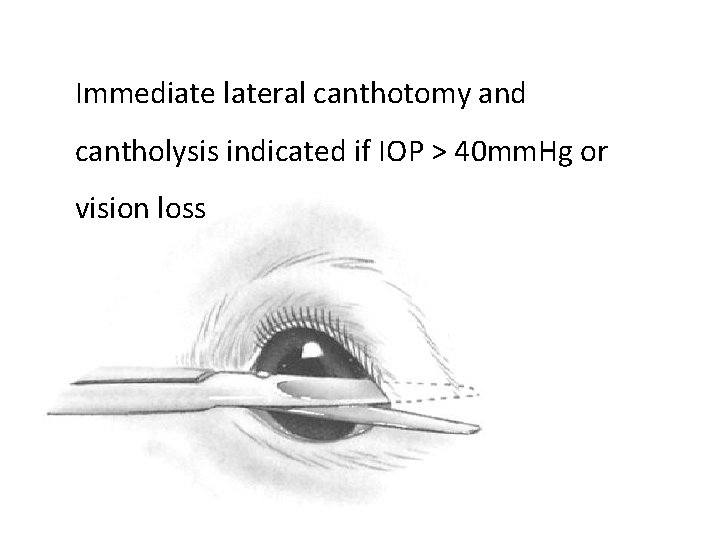 Immediate lateral canthotomy and cantholysis indicated if IOP > 40 mm. Hg or vision