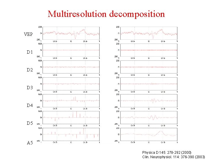 Multiresolution decomposition VEP D 1 D 2 D 3 D 4 D 5 A