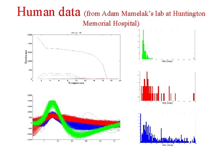 Human data (from Adam Mamelak’s lab at Huntington Memorial Hospital) 