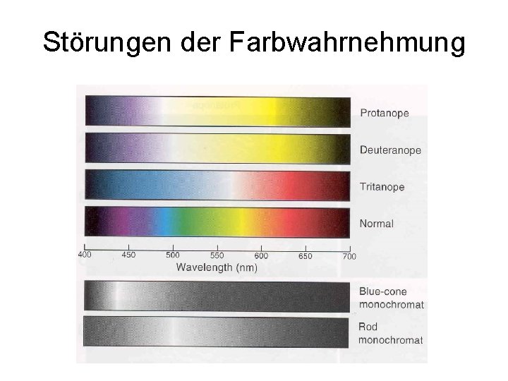 Störungen der Farbwahrnehmung 