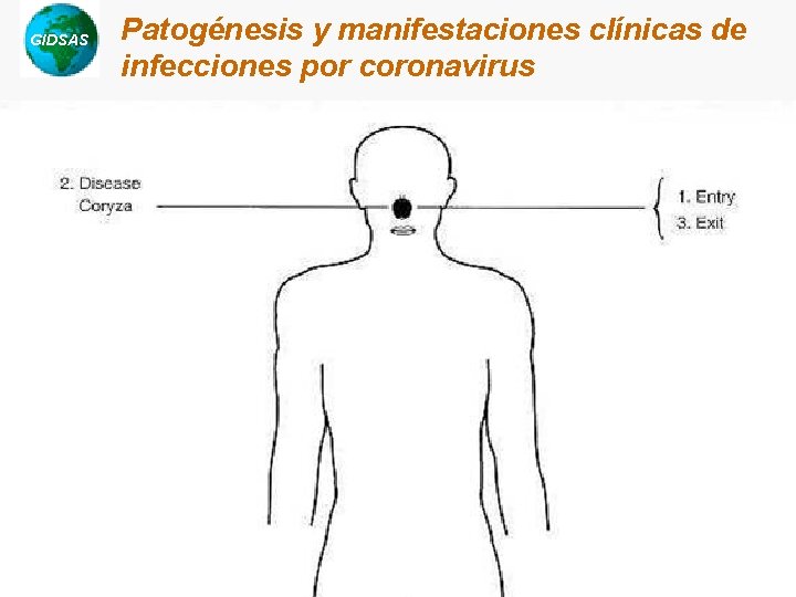 GIDSAS Chotani, 2003 Patogénesis y manifestaciones clínicas de infecciones por coronavirus GIDSAS Chotani, 2003 Patogénesis y manifestaciones clínicas de infecciones por coronavirus