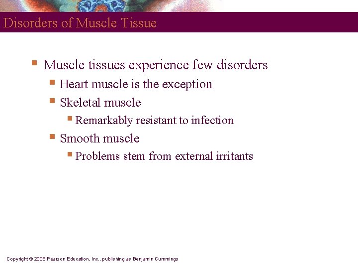 Disorders of Muscle Tissue § Muscle tissues experience few disorders § Heart muscle is