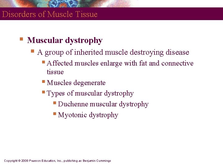 Disorders of Muscle Tissue § Muscular dystrophy § A group of inherited muscle destroying