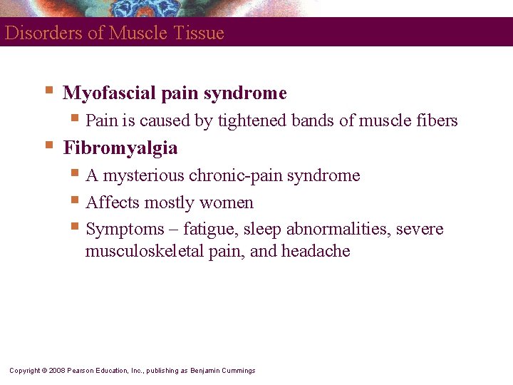 Disorders of Muscle Tissue § Myofascial pain syndrome § Pain is caused by tightened