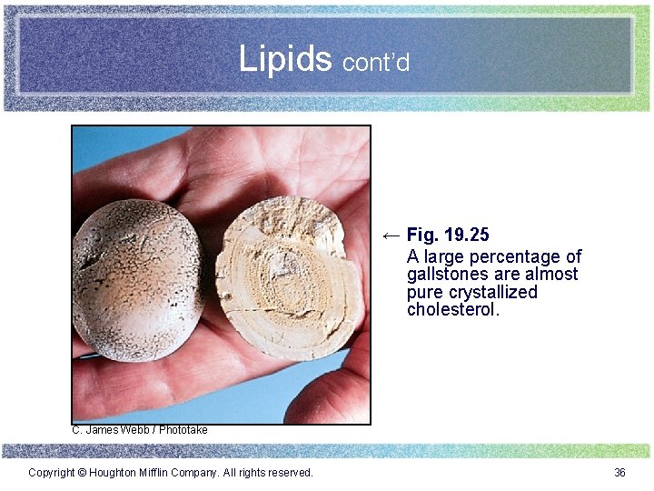 Lipids cont’d ← Fig. 19. 25 A large percentage of gallstones are almost pure