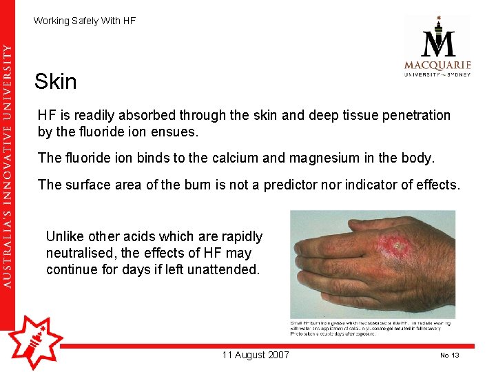 Working Safely With HF Skin HF is readily absorbed through the skin and deep Working Safely With HF Skin HF is readily absorbed through the skin and deep