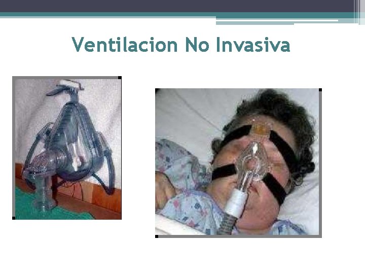 Ventilacion No Invasiva 