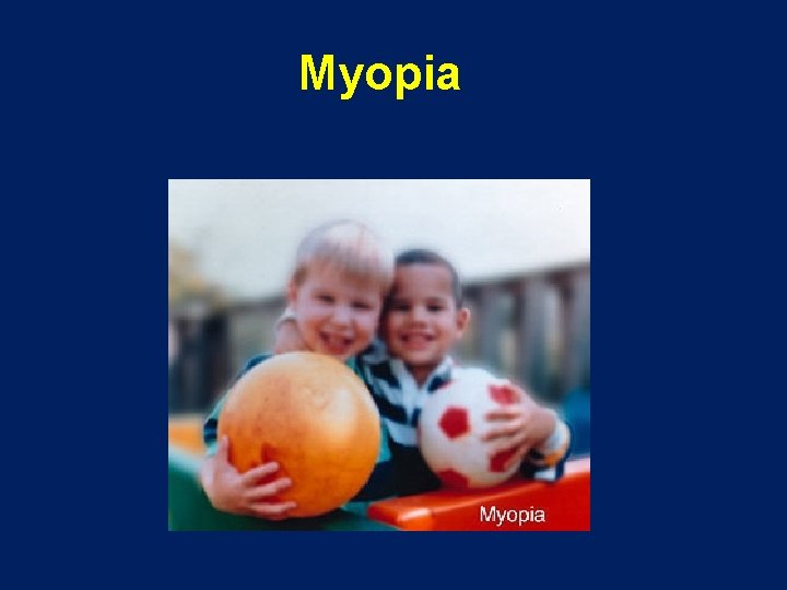 Myopia 