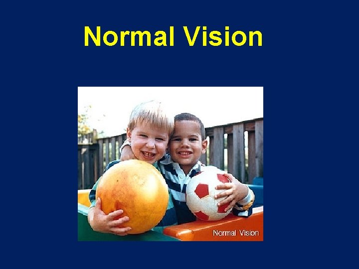 Normal Vision 