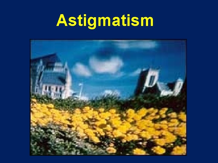 Astigmatism 