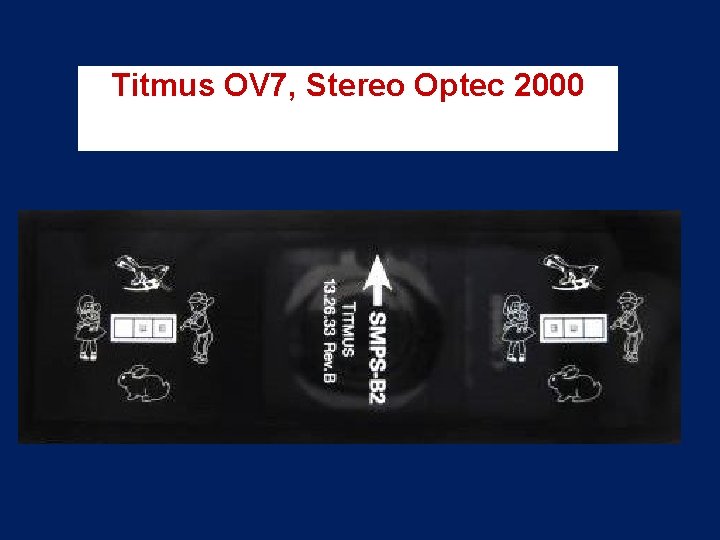 Titmus OV 7, Stereo Optec 2000 