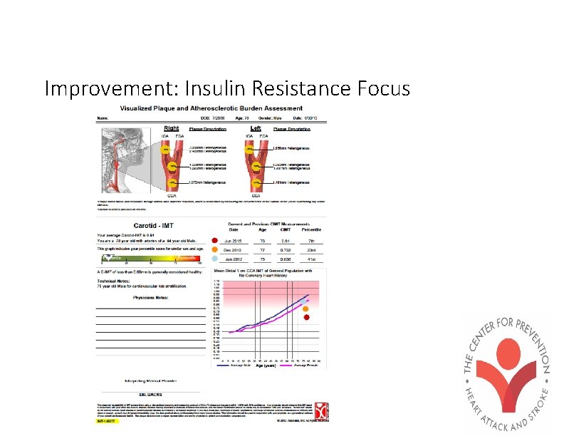 Improvement: Insulin Resistance Focus 