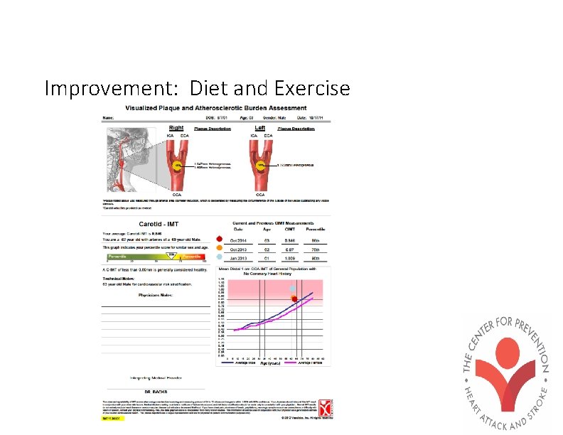 Improvement: Diet and Exercise 