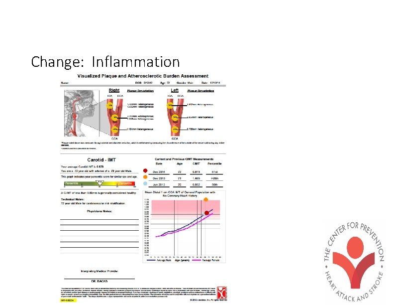 Change: Inflammation 