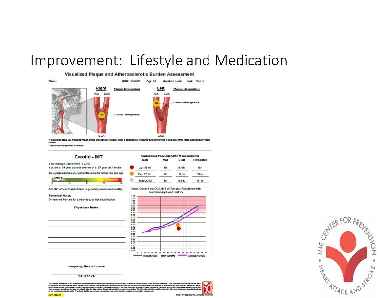 Improvement: Lifestyle and Medication 