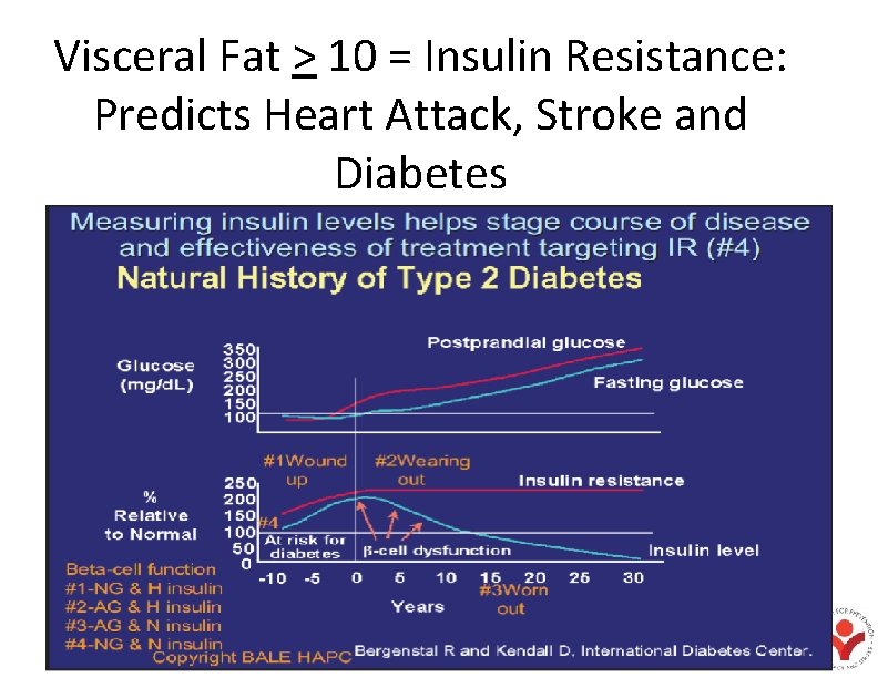 Visceral Fat > 10 = Insulin Resistance: Predicts Heart Attack, Stroke and Diabetes 