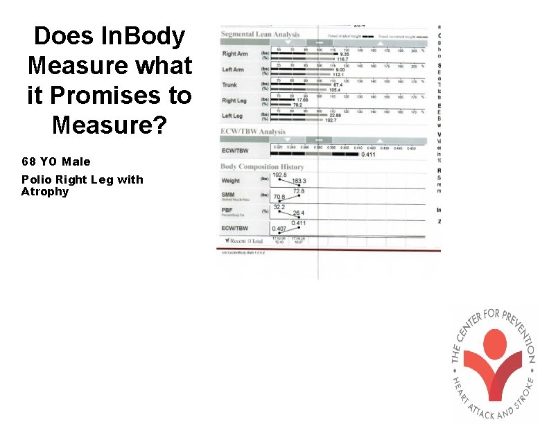 Does In. Body Measure what it Promises to Measure? 68 YO Male Polio Right