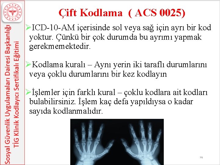 Çift Kodlama ( ACS 0025) ØICD-10 -AM içerisinde sol veya sağ için ayrı bir