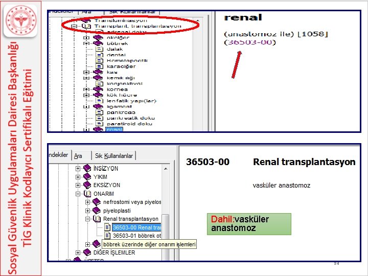 Dahil: vasküler anastomoz 84 