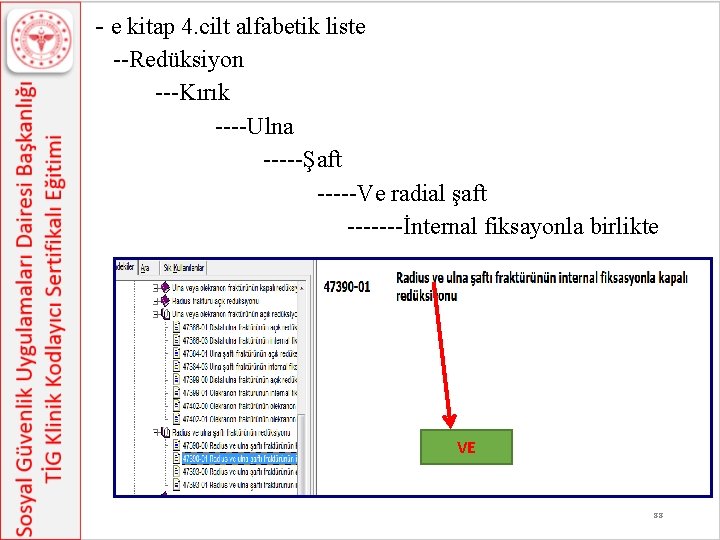 - e kitap 4. cilt alfabetik liste --Redüksiyon ---Kırık ----Ulna -----Şaft -----Ve radial şaft