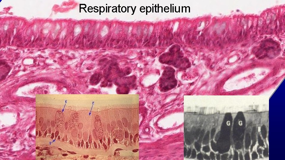 Respiratory epithelium 36 