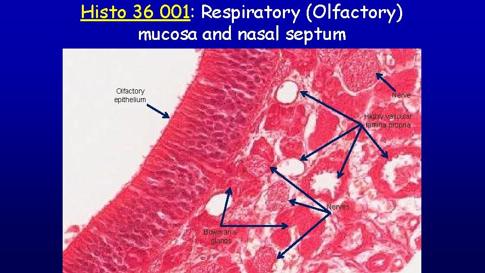 Histo 36 001: Respiratory (Olfactory) mucosa and nasal septum Olfactory epithelium Nerve Highly vascular
