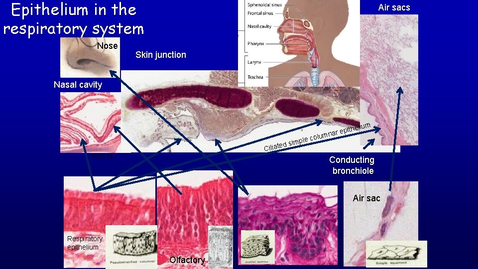 Epithelium in the respiratory system Nose Air sacs Skin junction Nasal cavity mple ted