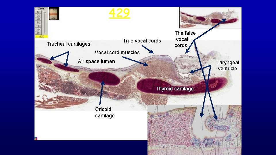 429 larynx True vocal cords Tracheal cartilages The false vocal cords Vocal cord muscles