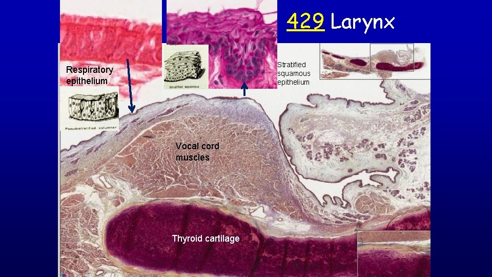 429 Larynx Stratified squamous epithelium Respiratory epithelium Vocal cord muscles Thyroid cartilage 