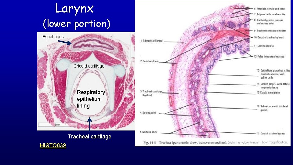 Larynx (lower portion) Esophagus Cricoid cartilage Respiratory epithelium lining Tracheal cartilage HISTO 039 