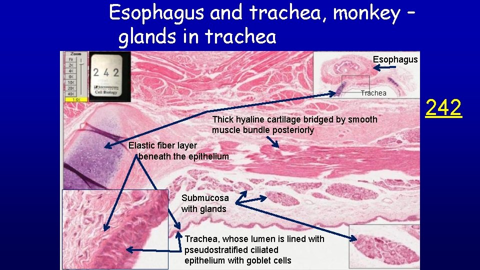 Esophagus and trachea, monkey – glands in trachea Esophagus Trachea Thick hyaline cartilage bridged