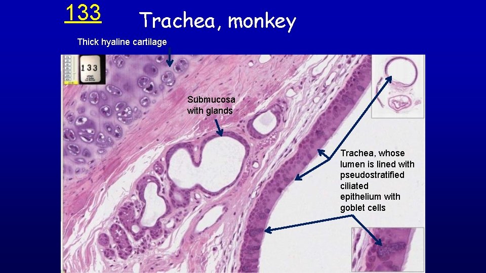 133 Trachea, monkey Thick hyaline cartilage Submucosa with glands Trachea, whose lumen is lined