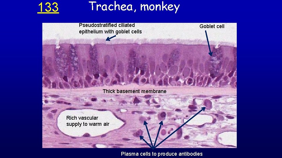 133 Trachea, monkey Pseudostratified ciliated epithelium with goblet cells Goblet cell Thick basement membrane