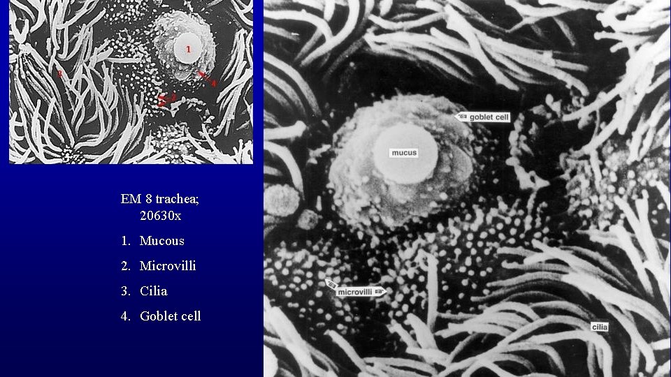 EM 8 trachea; 20630 x 1. Mucous 2. Microvilli 3. Cilia 4. Goblet cell