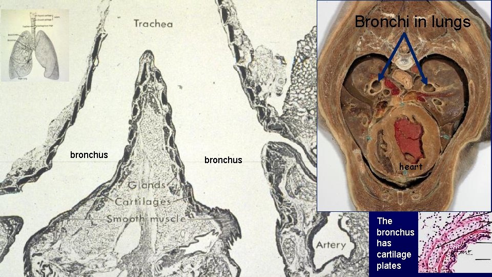 Bronchi in lungs bronchus heart The bronchus has cartilage plates 