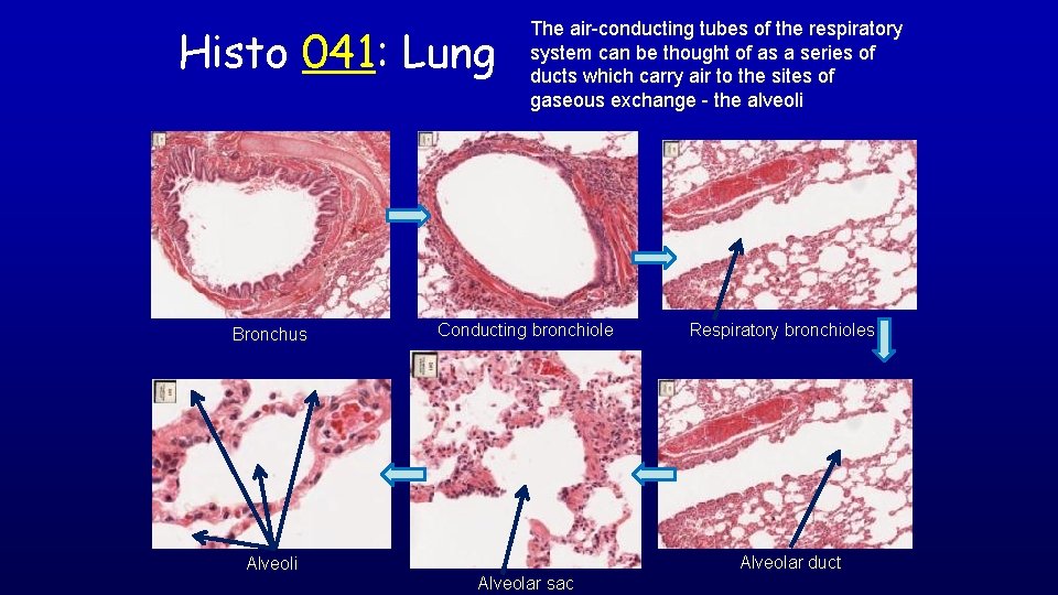 Histo 041: Lung Bronchus The air-conducting tubes of the respiratory system can be thought