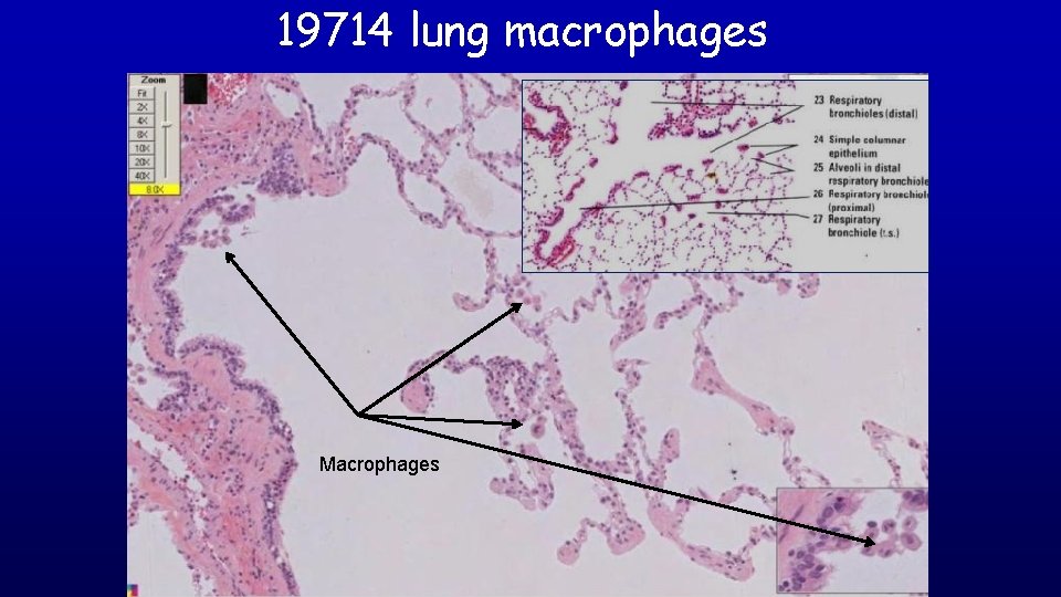 19714 lung macrophages Macrophages 